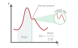 Pram Score Algorithm PRAM method – Hemodynamic Management / Vygon